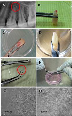 Stem Cells From the Apical Papilla (SCAP) as a Tool for Endogenous Tissue Regeneration